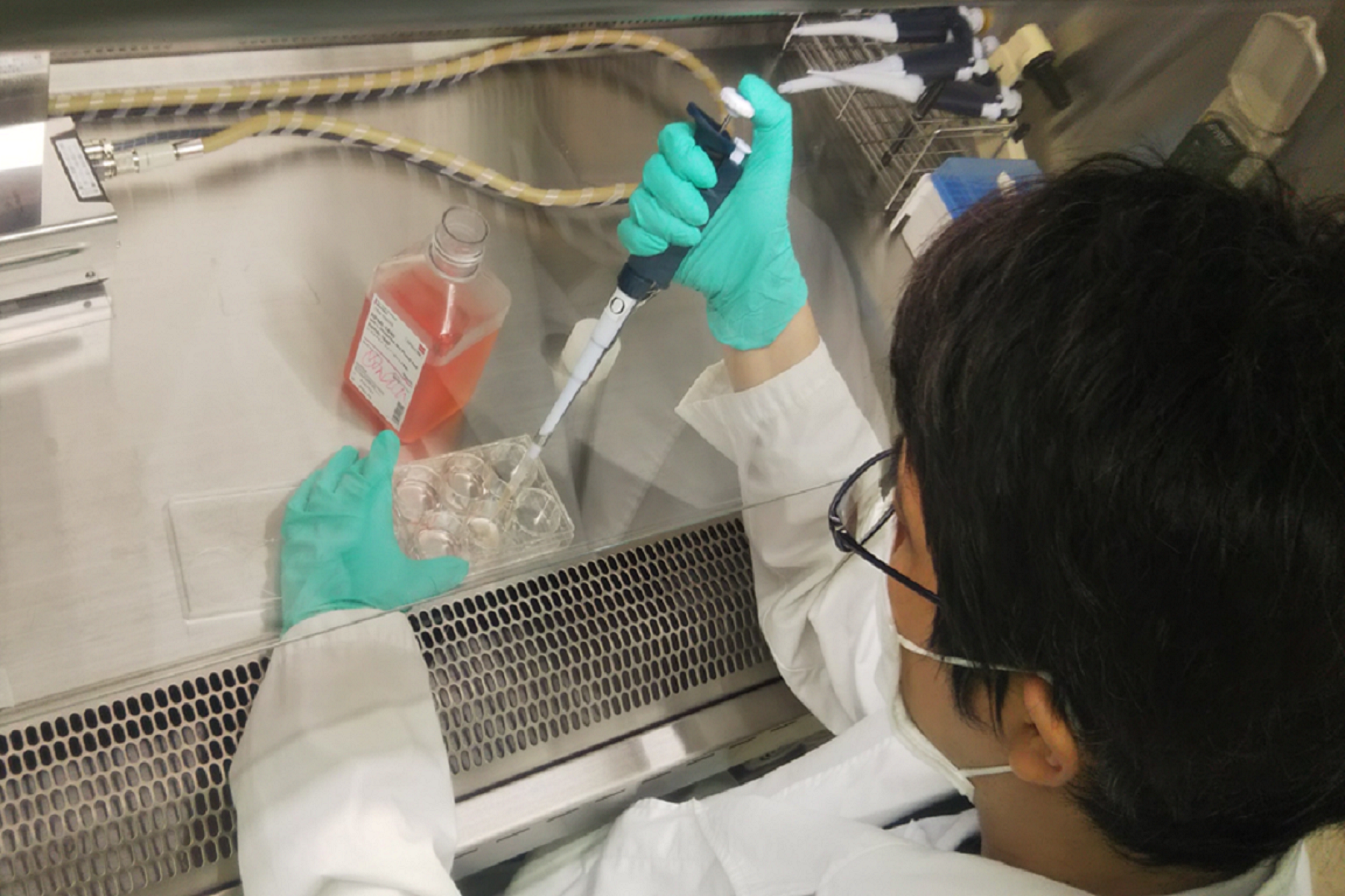 研究の様子（炎症性腸疾患の病態把握に有用な新規バイオマーカーの樹立）